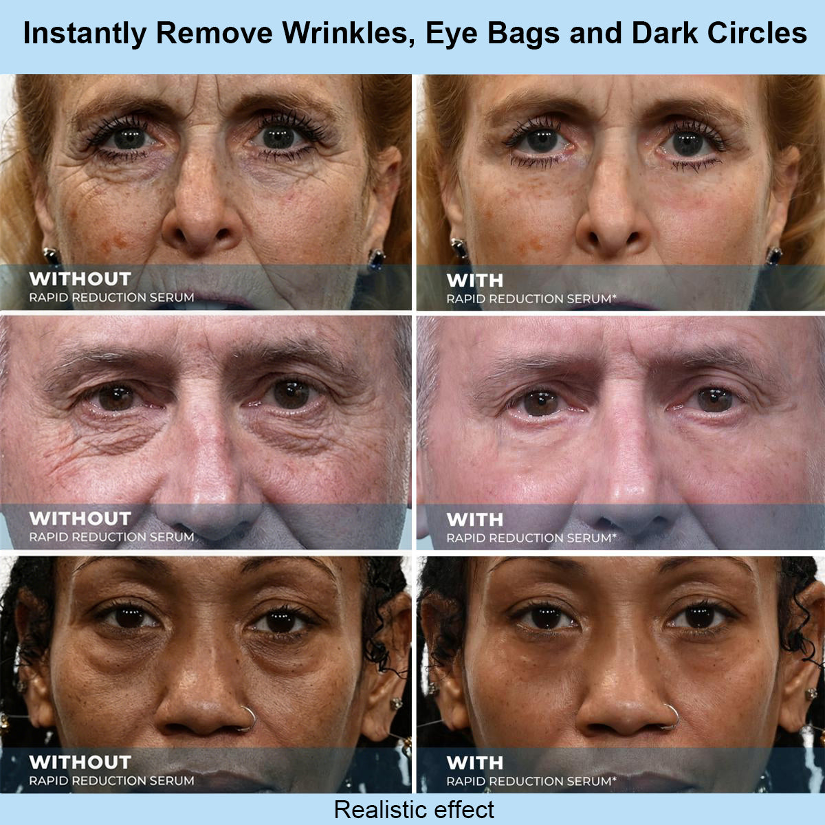 SKINMAGY™ Instant Face Temporary Tightener – Instant visible results in 30 seconds