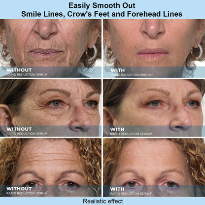 SKINMAGY™ Instant Face Temporary Tightener – Instant visible results in 30 seconds