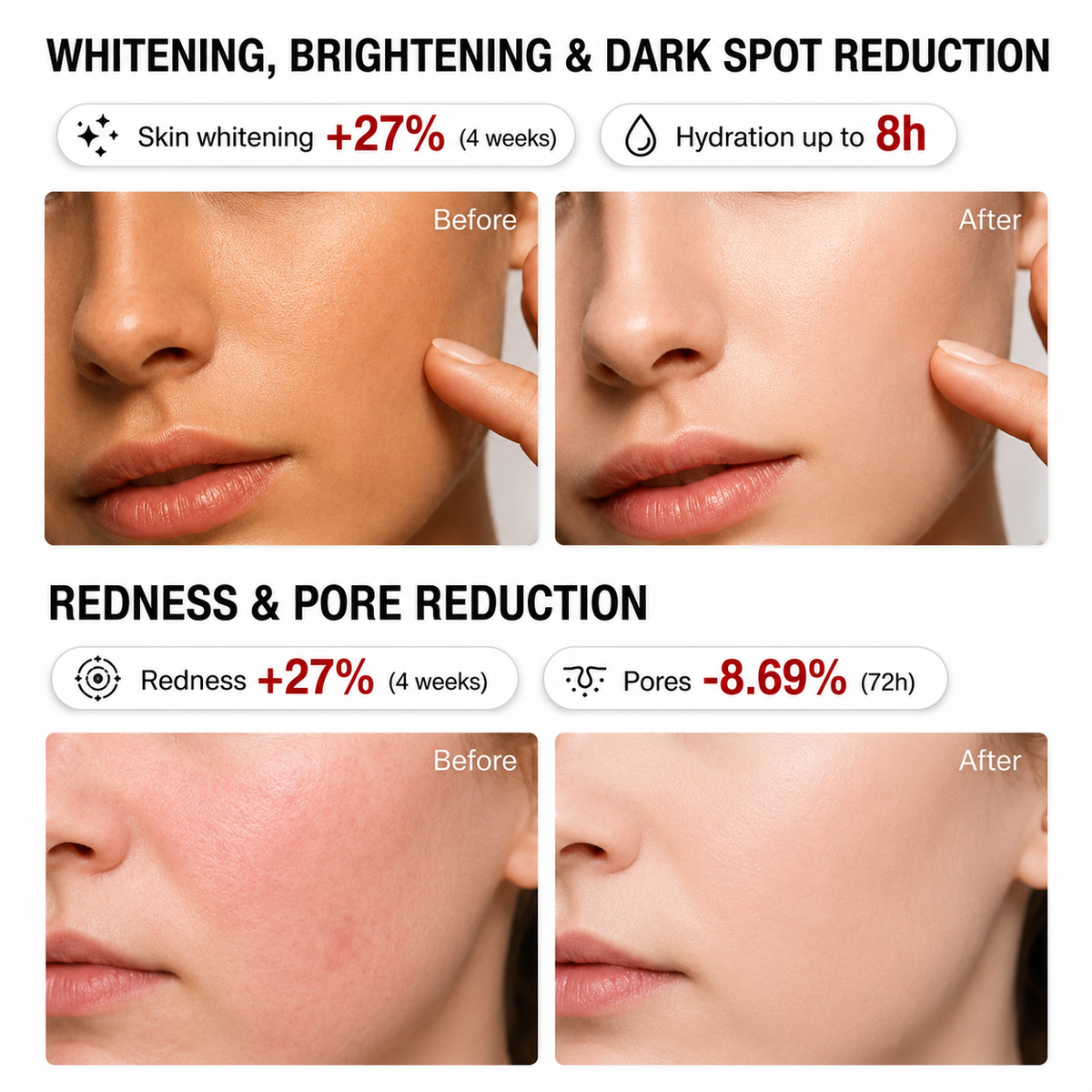 Last Day-Buy 1 Get 1 Free💙Niacinamide Brightening Essence, Inhibits Melanin, Reduces Acne Scars and Dark Spots, Whitening Serum