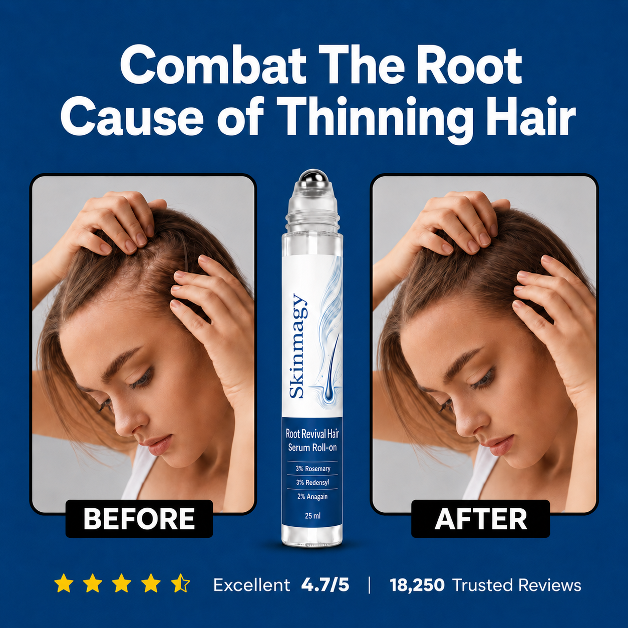 Skinmagy™ Root Revival Hair Roll On Serum