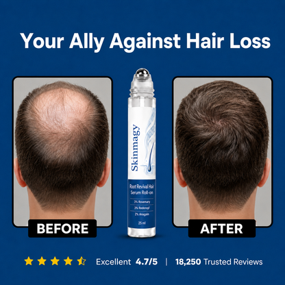 Skinmagy™ Root Revival Hair Roll On Serum