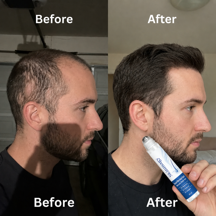 Easy scalp routine.