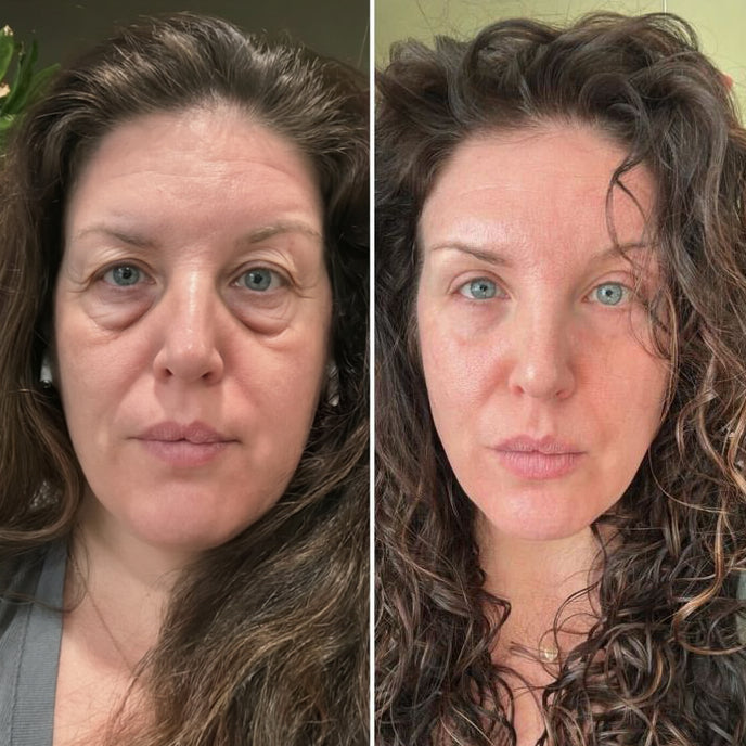 Before and after smoother looking skin
