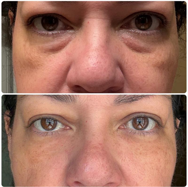 Carol B. customer review photo