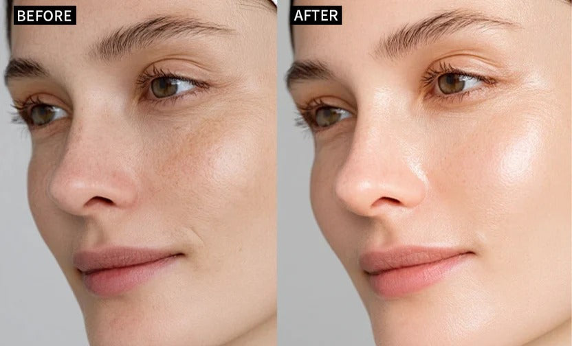 GopureMagy before and after style anti-wrinkle result image